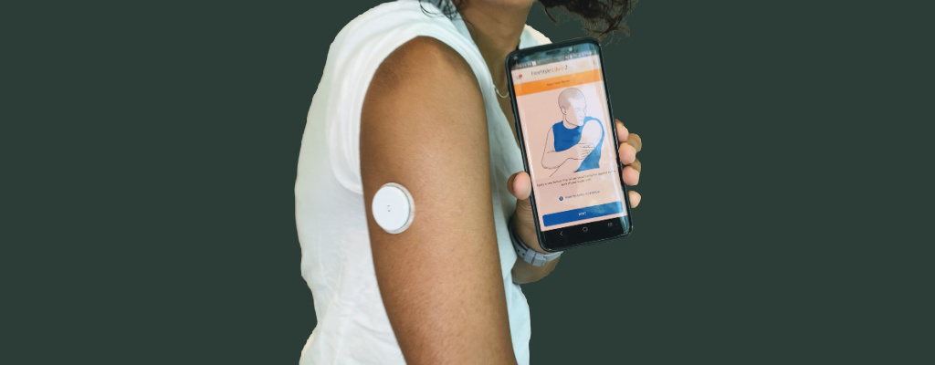 continuous glucose monitor